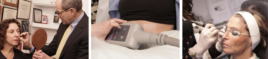 Close-up of a handheld device used for a cosmetic or medical treatment on the abdomen.