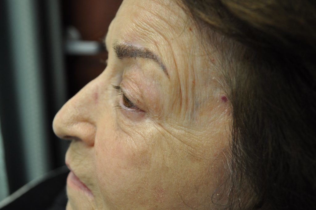 Close-up of an elderly woman's face showing wrinkles and skin texture.