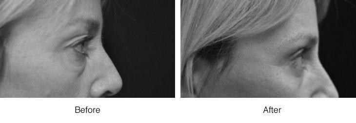 Close-up black and white photos of a nose and an ear.
