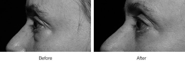 Close-up comparison of skin texture under different lighting conditions.