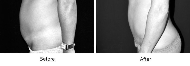 Black and white photo showing a person's arm and hand with a watch.